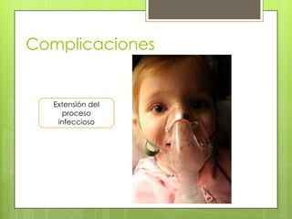 Complicaciones

Extensión del
proceso
infeccioso

 