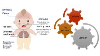 Estridor
Tos
perruna
Disfonía
Persona-Persona o
por secreciones
infectadas
 