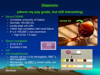 Crush injuries and rhabdomyolysis | PPTX