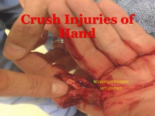 Crush Injuries of
Hand
MD.MONSUR RAHMAN
MPT-(ORTHO)
 