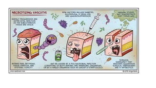 Compartment syndrome