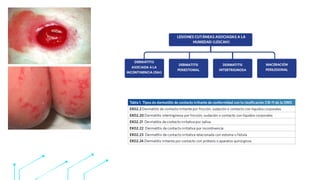 Técnica de Crusting con Cianoacrilato para Dermatitis Asociada a ...