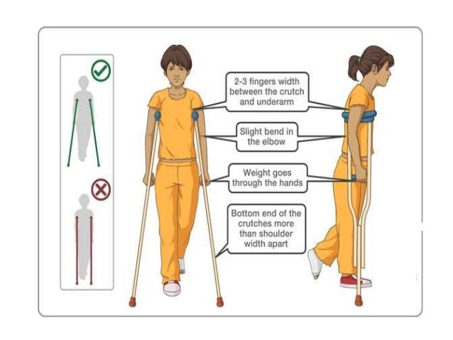 Image result for crutch walking