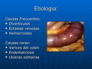 Etiología: Causas Frecuentes: Divertículos  Ectasias venosas Hemorroides Causas raras: Varices del colon Endometriosis Ulceras solitarias 