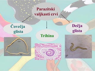 Parazitski
valjkasti crvi
Čovečja
glista
Trihina
Dečja
glista
 