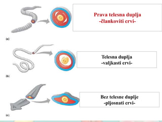 Prava telesna duplja
-člankoviti crvi-
Telesna duplja
-valjkasti crvi-
Bez telesne duplje
-pljosnati crvi-
 