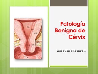 Patología
Benigna de
Cérvix
Wendy Cedillo Carpio
 