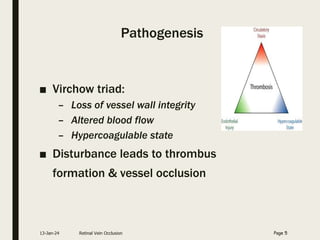 Pathogenesis
■ Virchow triad:
– Loss of vessel wall integrity
– Altered blood flow
– Hypercoagulable state
■ Disturbance leads to thrombus
formation & vessel occlusion
13-Jan-24 Retinal Vein Occlusion Page 5
 