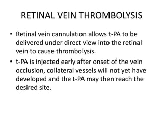 In SCORE-BRVO, which included a BRVO study cohort similar to that of the BVOS, intravitreal injections of triamcinoloneacetonide was not found to be associated with improved visual acuity outcomes compared with grid photocoagulation.