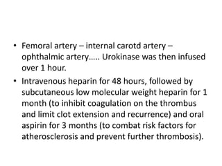 Cruise/Bravo StudyCruise study : 	CRVOBravo study :   BRVO    Two large-scale randomized clinical trials demonstrate that anti-VEGF therapy significantly improves vision in patients with central or branch retinal vein occlusion