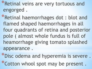 *Retinal veins are very tortuous and
engorged .
*Retinal haemorrhages dot : blot and
flamed shaped haemorrhages in all
four quadrants of retina and posterior
pole ( almost whole fundus is full of
heamorrhage giving tomato splashed
appearance .
*Disc odema and hyperemia is severe .
*Cotton whool spot may be present .
 
