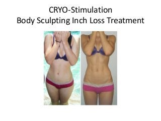 CRYO-Stimulation
Body Sculpting Inch Loss Treatment
 