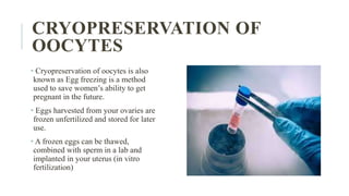 CRYOPRESERVATION OF
OOCYTES
• Cryopreservation of oocytes is also
known as Egg freezing is a method
used to save women’s ability to get
pregnant in the future.
• Eggs harvested from your ovaries are
frozen unfertilized and stored for later
use.
• A frozen eggs can be thawed,
combined with sperm in a lab and
implanted in your uterus (in vitro
fertilization)
 