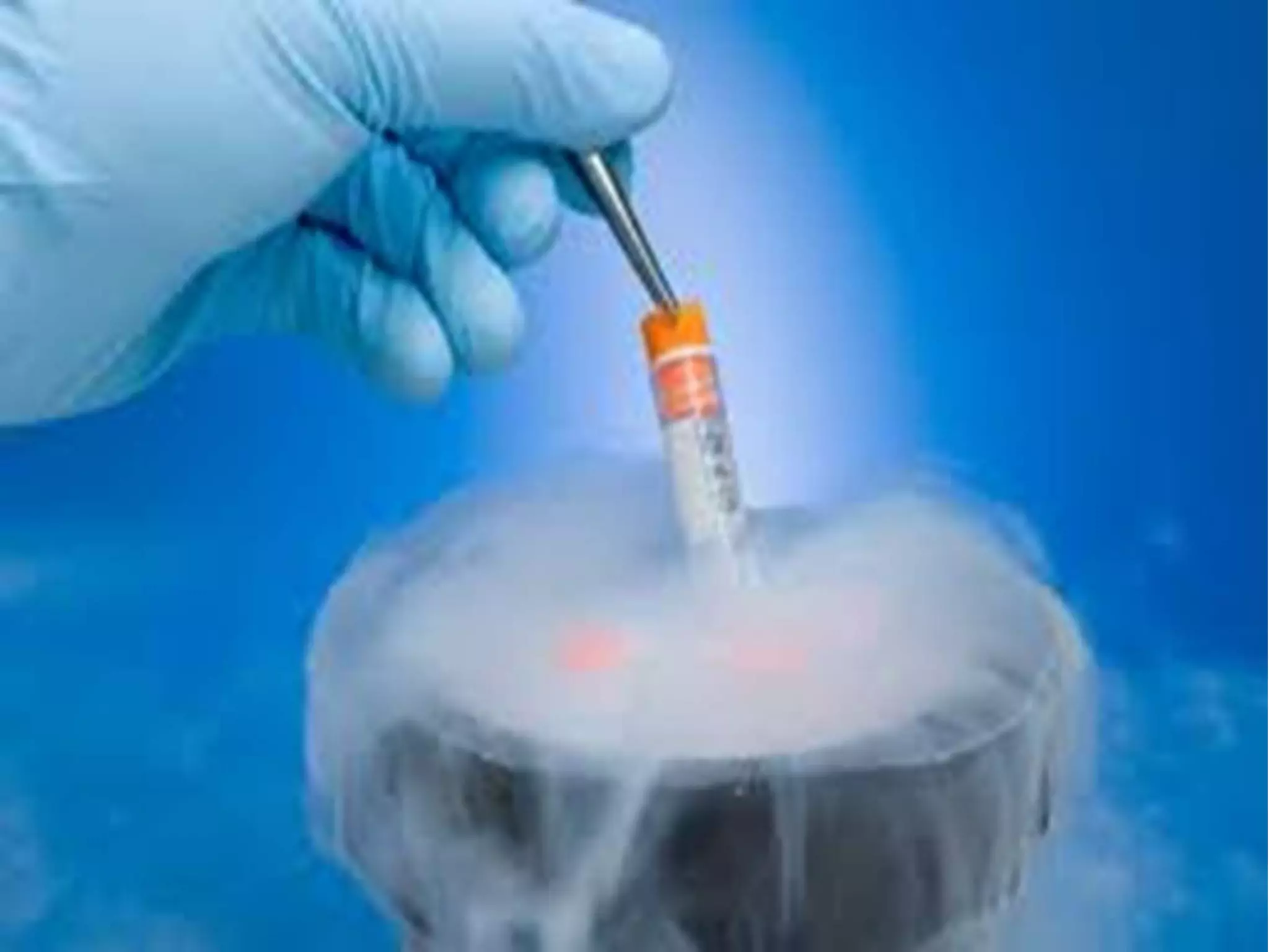Cryopreservation,sperm banking,artificial insemination | PPTX