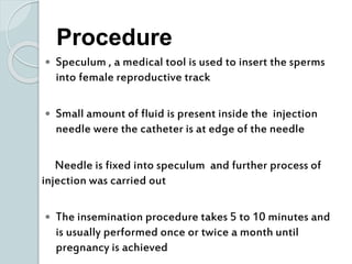  Speculum , a medical tool is used to insert the sperms
into female reproductive track
 Small amount of fluid is present inside the injection
needle were the catheter is at edge of the needle
Needle is fixed into speculum and further process of
injection was carried out
 The insemination procedure takes 5 to 10 minutes and
is usually performed once or twice a month until
pregnancy is achieved
Procedure
 