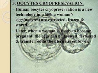 3. OOCYTES CRYOPRESEVATION.
• Human oocytes cryopreservation is a new
technology in which a woman’s
eggs(oocytes) are extracted, frozen &
stored.
• Later, when a woman is ready to become
pregnant, the eggs can be thawed, fertilized
& transferred to the uterus as embryos.
 