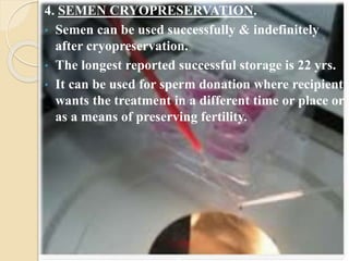 4. SEMEN CRYOPRESERVATION.
• Semen can be used successfully & indefinitely
after cryopreservation.
• The longest reported successful storage is 22 yrs.
• It can be used for sperm donation where recipient
wants the treatment in a different time or place or
as a means of preserving fertility.
 