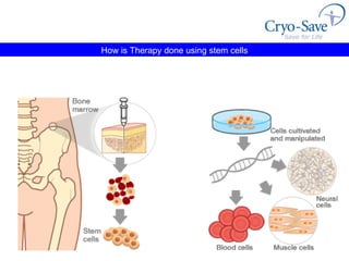 How is Therapy done using stem cells 