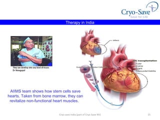 Cryo-save India (part of Cryo-Save NV) Therapy in India AIIMS team shows how stem cells save hearts. Taken from bone marrow, they can revitalize non-functional heart muscles.   