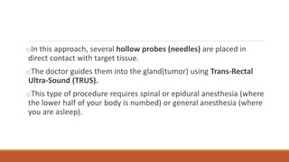 oIn this approach, several hollow probes (needles) are placed in 
direct contact with target tissue. 
oThe doctor guides them into the gland(tumor) using Trans-Rectal 
Ultra-Sound (TRUS). 
oThis type of procedure requires spinal or epidural anesthesia (where 
the lower half of your body is numbed) or general anesthesia (where 
you are asleep). 
 