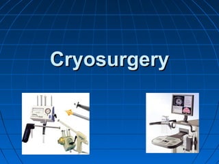 CryosurgeryCryosurgery
 