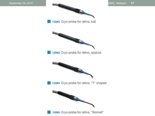 Cryotherapy in Ophthalmology | PPTX