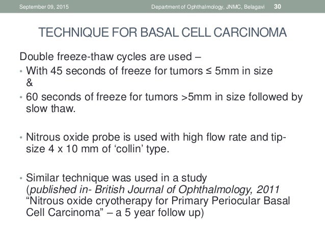 cryotherapy ophthalmology