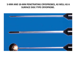 5-MM AND 10-MM PENETRATING CRYOPROBES, AS WELL AS A
SURFACE DISC-TYPE CRYOPROBE.
 