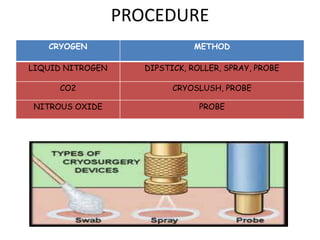 PROCEDURE
CRYOGEN METHOD
LIQUID NITROGEN DIPSTICK, ROLLER, SPRAY, PROBE
CO2 CRYOSLUSH, PROBE
NITROUS OXIDE PROBE
 