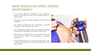 WHAT SHOULD WE EXPECT DURING
CRYOTHERAPY?
▪ If you have external cryotherapy, your healthcare
provider will apply the cold with a spraying device or
cotton swab.
▪ Providers usually use liquid nitrogen for this type of
treatment.
▪ For internal cryotherapy, the cryoprobe is inserted
through a small incision in your skin.
▪ Your healthcare provider may use ultrasound imaging
to guide the cryoprobe to the tissue to be frozen.
▪ Depending on the location of the abnormal cells, you
may be given either local anesthesia or general
anesthesia.
▪ Local anesthesia works to numb a specific spot, while
a general anesthesia is used during surgeries to put
you to sleep.
 