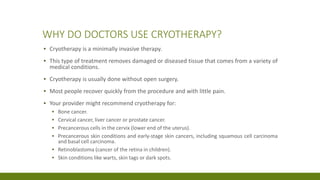 WHY DO DOCTORS USE CRYOTHERAPY?
▪ Cryotherapy is a minimally invasive therapy.
▪ This type of treatment removes damaged or diseased tissue that comes from a variety of
medical conditions.
▪ Cryotherapy is usually done without open surgery.
▪ Most people recover quickly from the procedure and with little pain.
▪ Your provider might recommend cryotherapy for:
▪ Bone cancer.
▪ Cervical cancer, liver cancer or prostate cancer.
▪ Precancerous cells in the cervix (lower end of the uterus).
▪ Precancerous skin conditions and early-stage skin cancers, including squamous cell carcinoma
and basal cell carcinoma.
▪ Retinoblastoma (cancer of the retina in children).
▪ Skin conditions like warts, skin tags or dark spots.
 