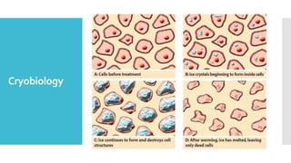 Cryobiology
Liquid nitrogen sprays & cotton swabs are more accessible to
clinicians but are not suitable for use in the oral cavity due to lack
of control over the temperature achieved within cells and the area
of freezing, which makes this method hazardous to use intraorally
 