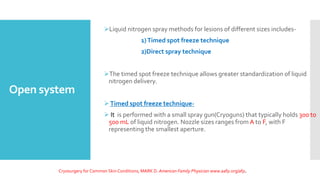 Open system
Liquid nitrogen spray methods for lesions of different sizes includes-
1)Timed spot freeze technique
2)Direct spray technique
The timed spot freeze technique allows greater standardization of liquid
nitrogen delivery.
Timed spot freeze technique-
 It is performed with a small spray gun(Cryoguns) that typically holds 300 to
500 mL of liquid nitrogen. Nozzle sizes ranges from A to F, with F
representing the smallest aperture.
Cryosurgery for Common SkinConditions, MARK D. American Family Physician www.aafp.org/afp.
 