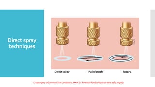 Direct spray
techniques
Cryosurgery forCommon Skin Conditions, MARK D. American Family Physician www.aafp.org/afp.
Direct spray Paint brush Rotary
 
