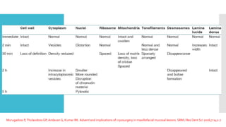 Murugadoss P,Thulasidoss GP,Andavan G, Kumar RK. Advent and implications of cryosurgery in maxillofacial mucosal lesions. SRM J Res Dent Sci 2016;7:242-7
 
