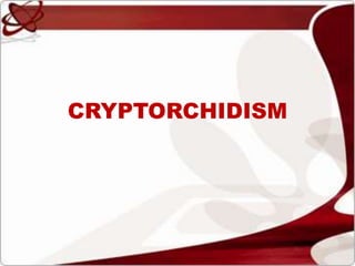 CRYPTORCHIDISM
 