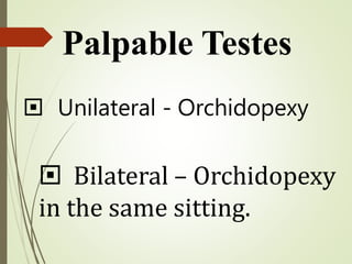  Unilateral - Orchidopexy
 Bilateral – Orchidopexy
in the same sitting.
Palpable Testes
 