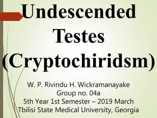 Undescended
Testes
(Cryptochiridsm)
W. P. Rivindu H. Wickramanayake
Group no. 04a
5th Year 1st Semester – 2019 March
Tbilisi State Medical University, Georgia
 