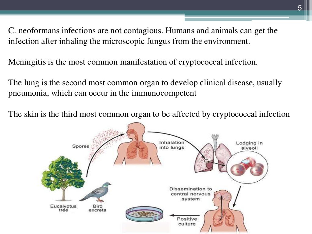 Cryptococcal Meningitis SEMINAR