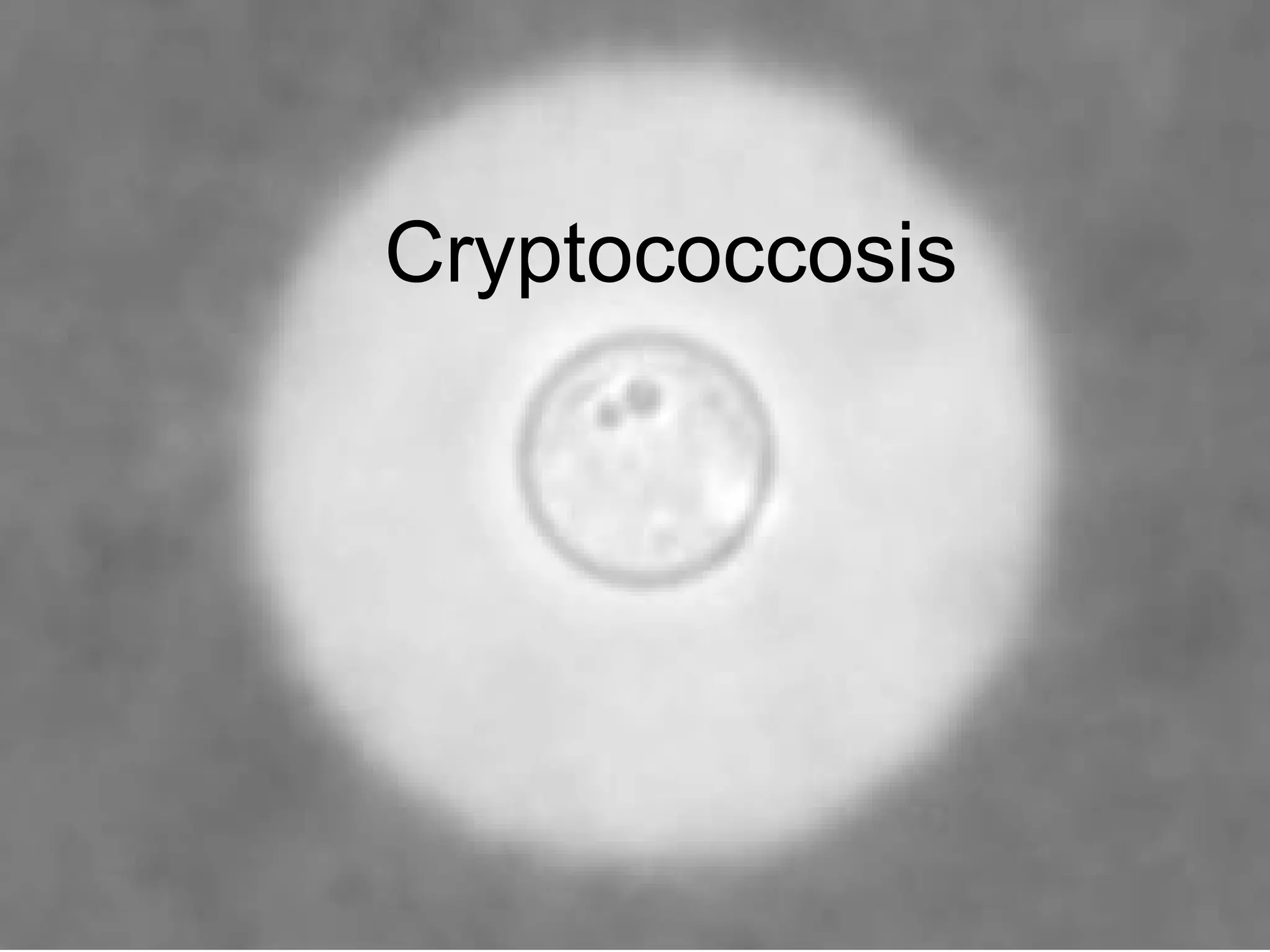 Cryptococcosis neetu | PPT