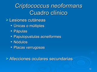 Criptococcus neoformans  Cuadro clínico Lesiones cutáneas Únicas o múltiples Pápulas Papulopustulas acneiformes Nódulos Placas verrugosas Afecciones oculares secundarias  