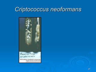 Criptococcus neoformans 