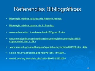 Referencias Bibliográficas Micología médica ilustrada de Roberto Arenas. Micología médica básica  de A. Bonifaz. www.uninet.edu /.../conferencias/015/figura15.htm www.encolombia.com/medicina/neumologia/neumologia16104-criptocosis1.htm - 15k - www.nlm.nih.gov/medlineplus/spanish/ency/article/001328.htm - 28k scielo - mx.bvs.br / scielo.php?pid =S1665-1146200... www2. bvs.org.ve / scielo.php?pid =S0075-52222005 