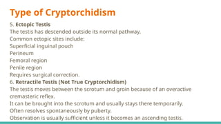 Type of Cryptorchidism
5. Ectopic Testis
The testis has descended outside its normal pathway.
Common ectopic sites include:
Superficial inguinal pouch
Perineum
Femoral region
Penile region
Requires surgical correction.
6. Retractile Testis (Not True Cryptorchidism)
The testis moves between the scrotum and groin because of an overactive
cremasteric reflex.
It can be brought into the scrotum and usually stays there temporarily.
Often resolves spontaneously by puberty.
Observation is usually sufficient unless it becomes an ascending testis.
 