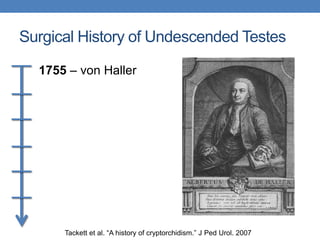 Surgical History of Undescended Testes
1755 – von Haller
Tackett et al. “A history of cryptorchidism.” J Ped Urol. 2007
 