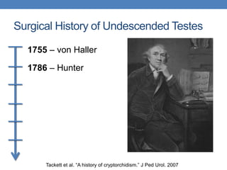 Surgical History of Undescended Testes
1755 – von Haller
1786 – Hunter
Tackett et al. “A history of cryptorchidism.” J Ped Urol. 2007
 