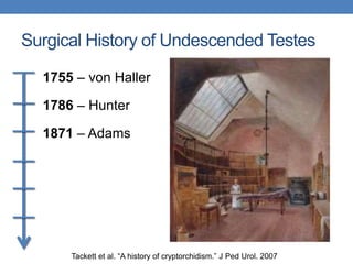 Surgical History of Undescended Testes
1755 – von Haller
1786 – Hunter
1871 – Adams
Tackett et al. “A history of cryptorchidism.” J Ped Urol. 2007
 