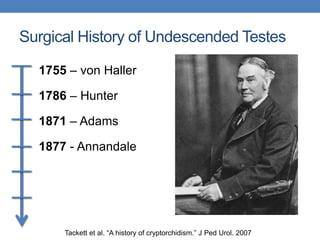 Surgical History of Undescended Testes
1755 – von Haller
1786 – Hunter
1871 – Adams
1877 - Annandale
Tackett et al. “A history of cryptorchidism.” J Ped Urol. 2007
 