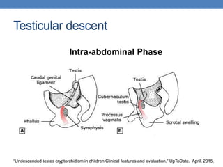 Testicular descent
Intra-abdominal Phase
“Undescended testes cryptorchidism in children Clinical features and evaluation.” UpToDate. April, 2015.
 
