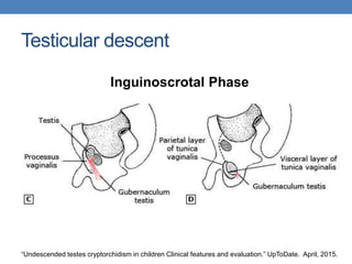Testicular descent
Inguinoscrotal Phase
“Undescended testes cryptorchidism in children Clinical features and evaluation.” UpToDate. April, 2015.
 